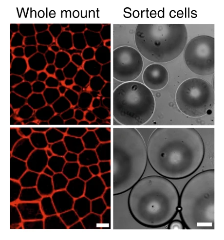 Adipocyte Sorting